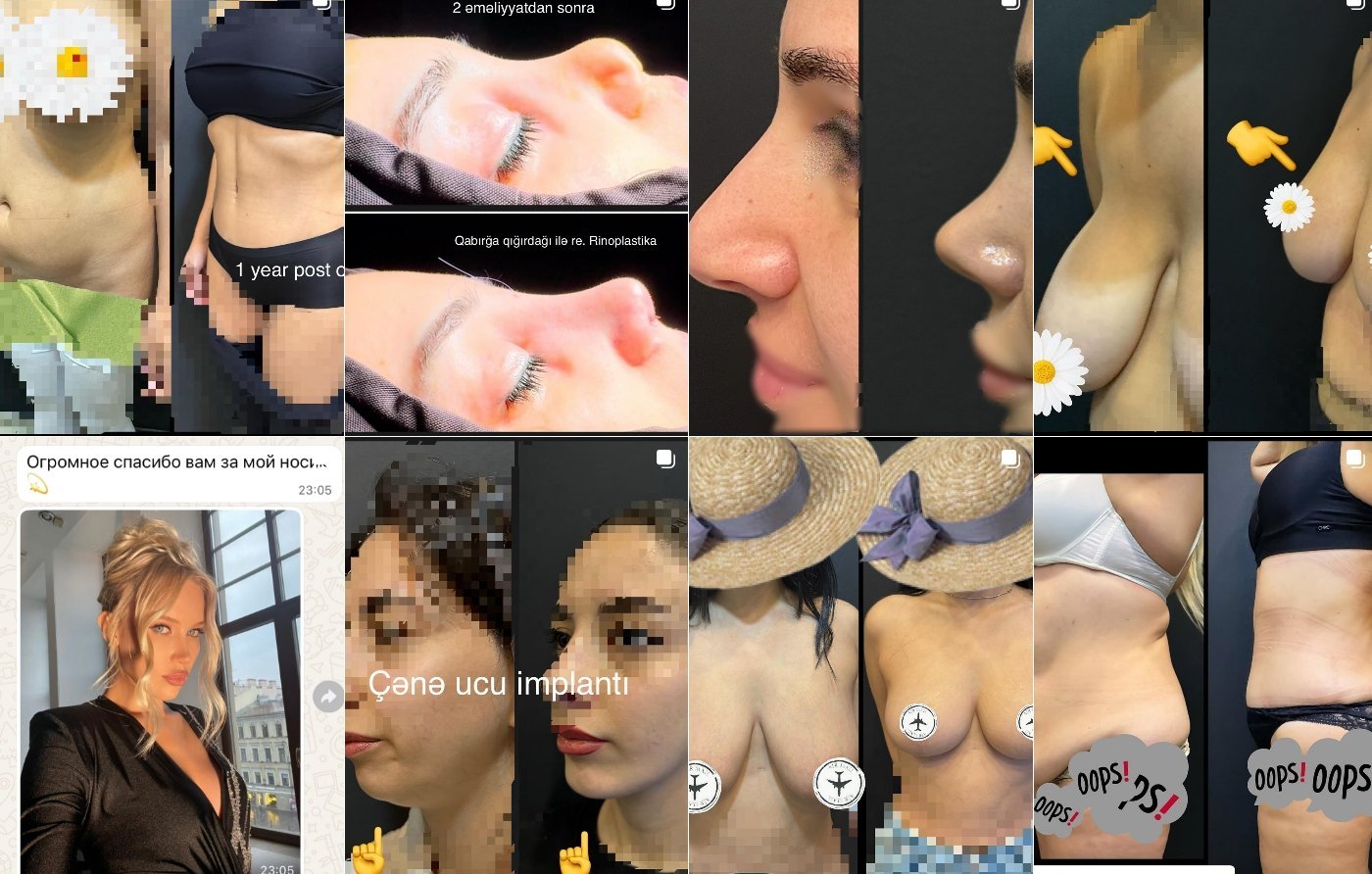 Peşəkarlıq və Etibarın Ünvanı – Dr. Dilqəm Məhərrəmov haqqında yayılan əsassız iddialara münasibət