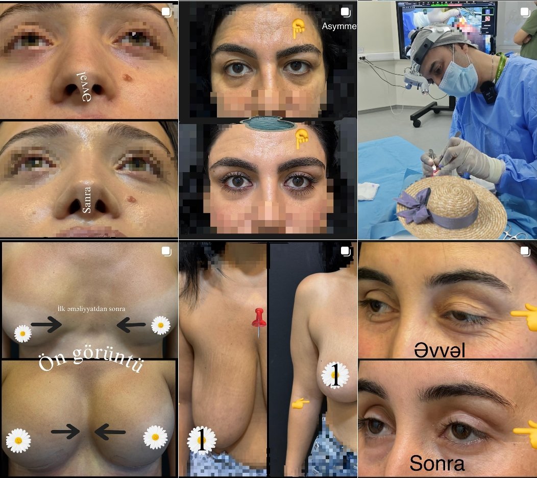 Peşəkarlıq və Etibarın Ünvanı – Dr. Dilqəm Məhərrəmov haqqında yayılan əsassız iddialara münasibət